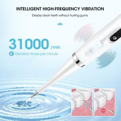 Professional Ultrasonic Teeth Cleaner